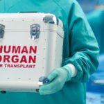 human organ transplant