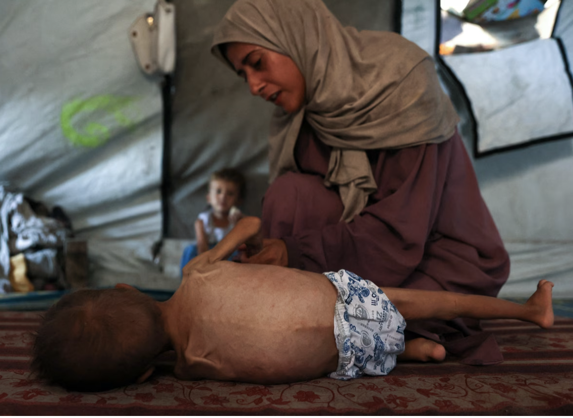 Gaza Starvation Photos Tell a Thousand Lies