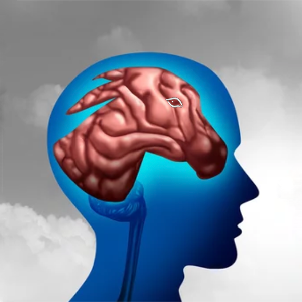 Liberal Mind - blue head with _donkey shaped brain_