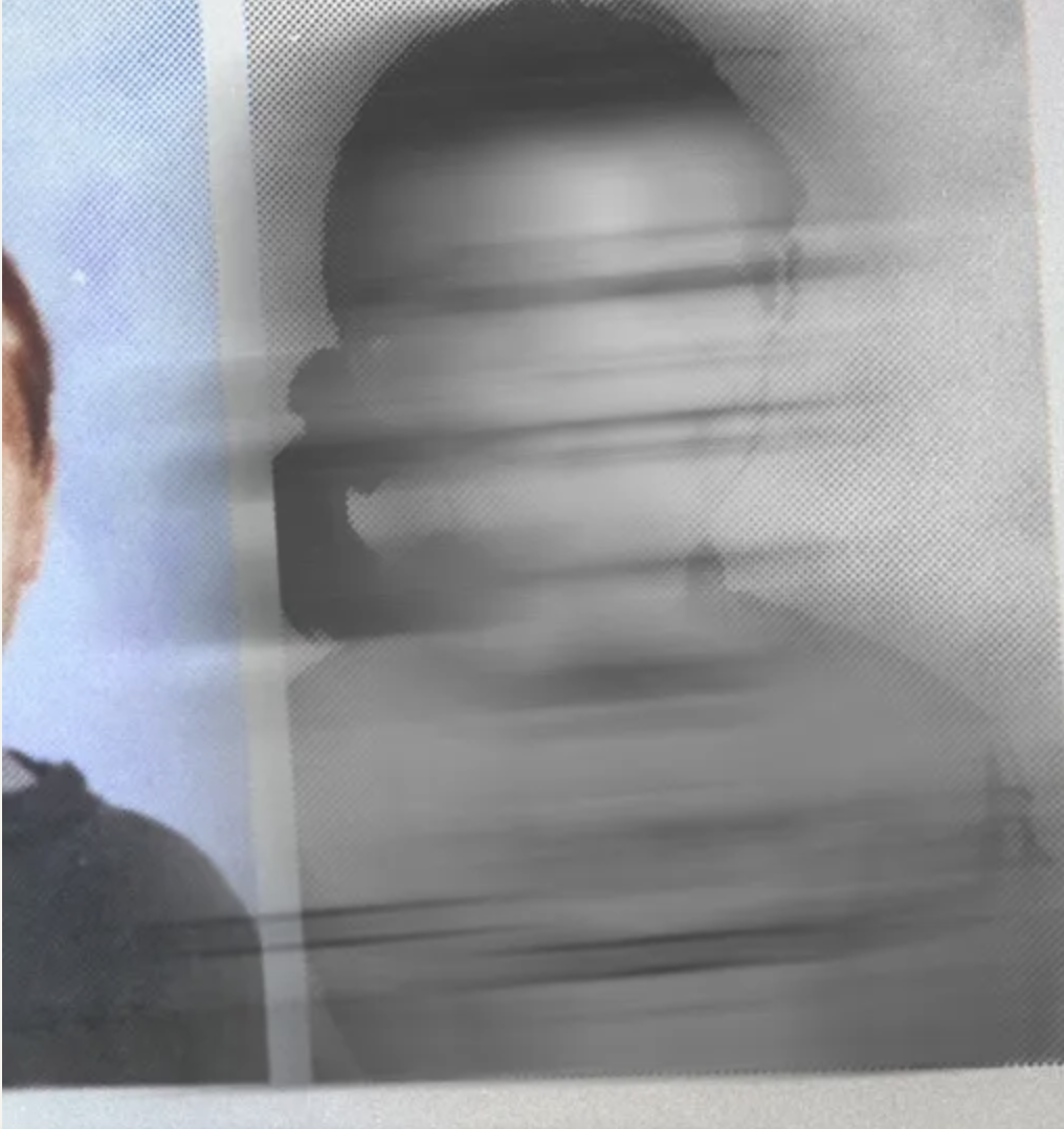 Fall of Youth Gender Medicine