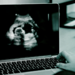 Fertility Treatment Beyond the Quick Fix